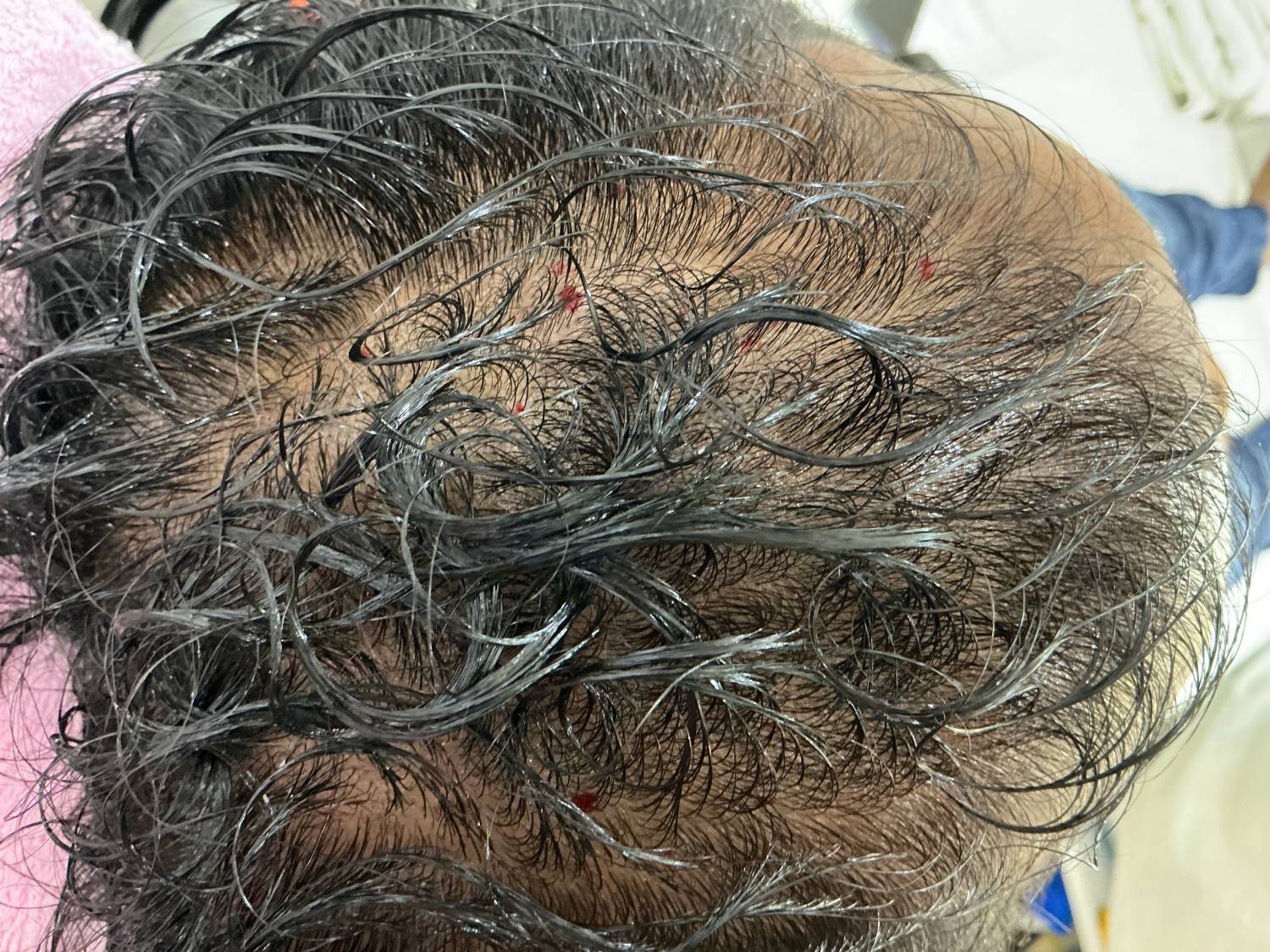 After treatment