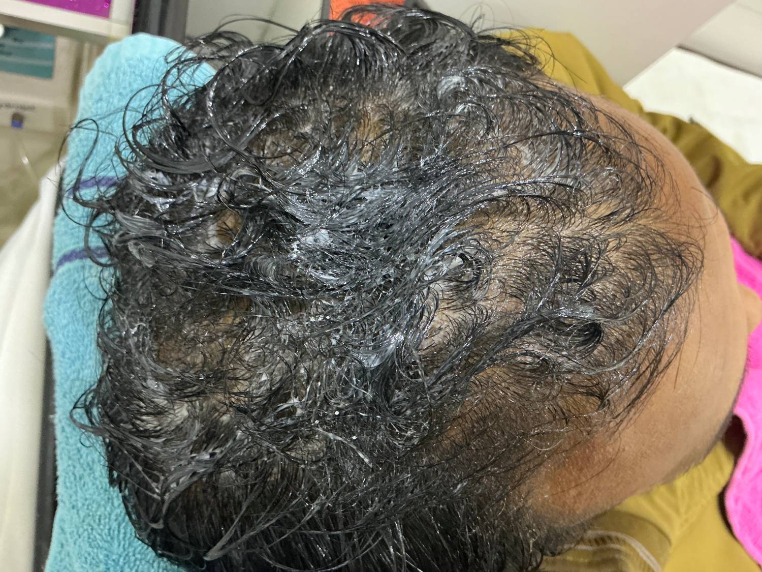 Before treatment